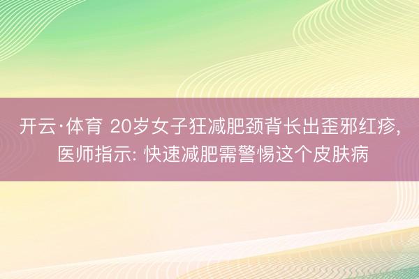 开云·体育 20岁女子狂减肥颈背长出歪邪红疹， 医师指示: 快速减肥需警惕这个皮肤病